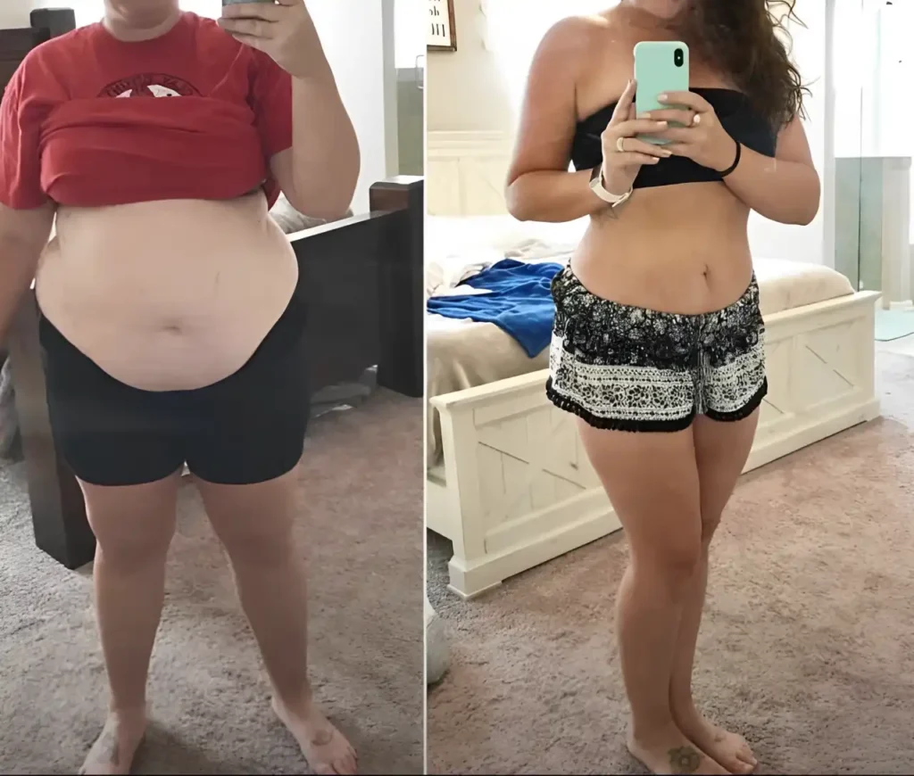 Before and after photo of a woman showing significant weight loss progress